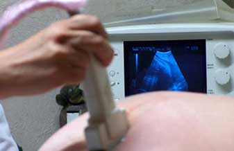 Maria Selma Lins Tavares - Foto 1